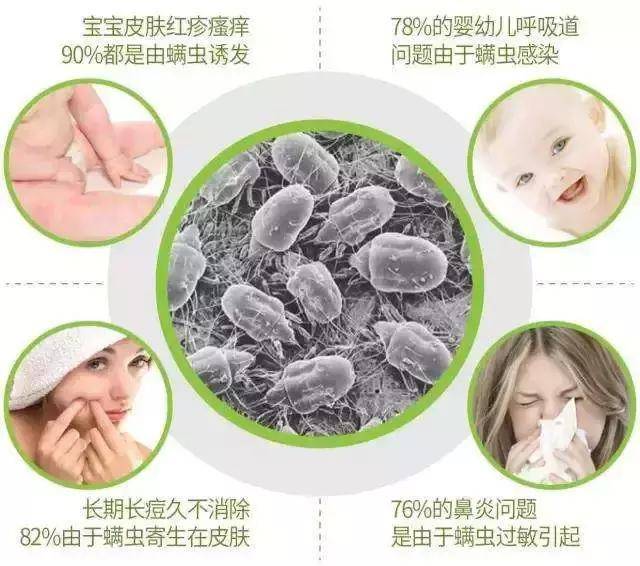 小巷深处的特色驱螨小店探秘